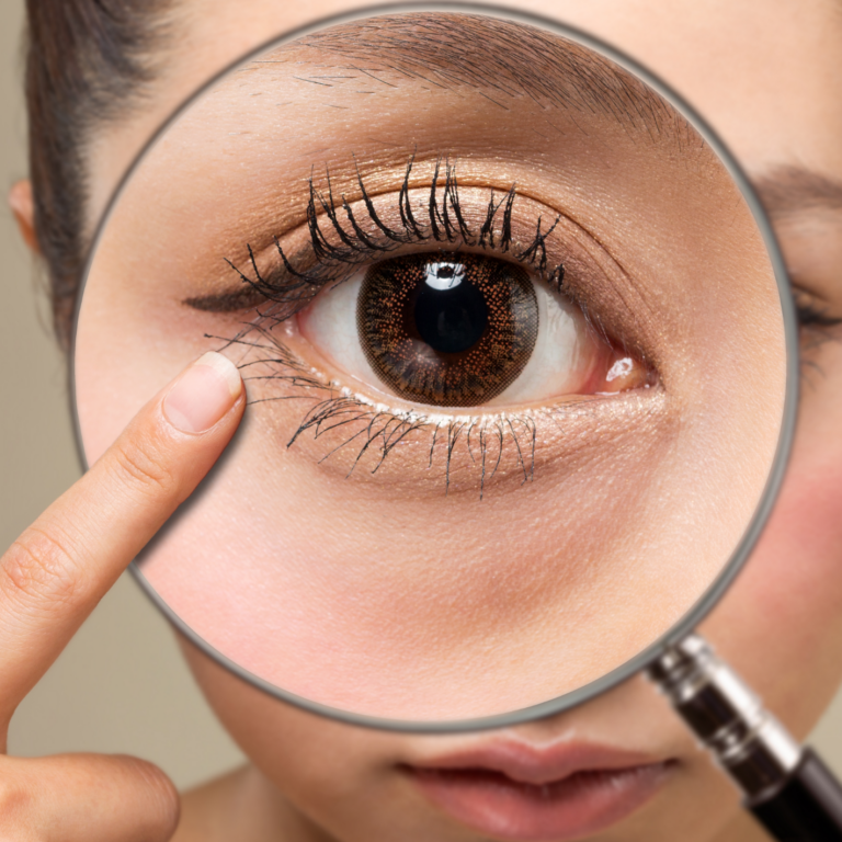 Wandernde Schlieren vor den Augen: Was sind Mouches volantes? | Thealoz Duo